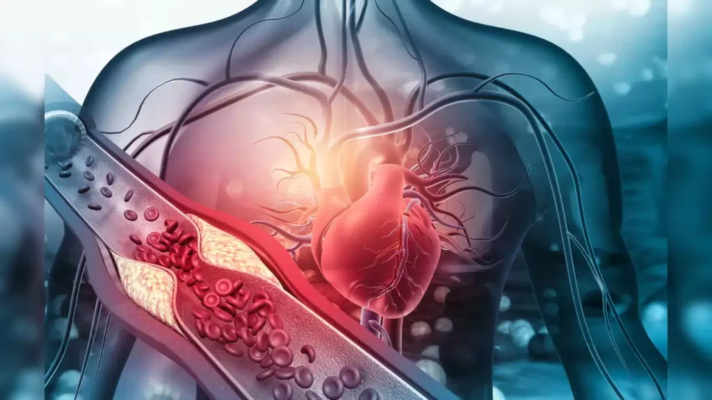 Exploring the Link Between Hypertension and Heart Stroke